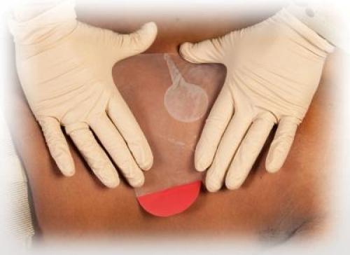 Повязка черепашья сходящаяся на коленный сустав. Техника наложения 08 Повязка черепашья сходящаяся на коленный сустав. Техника наложения 08