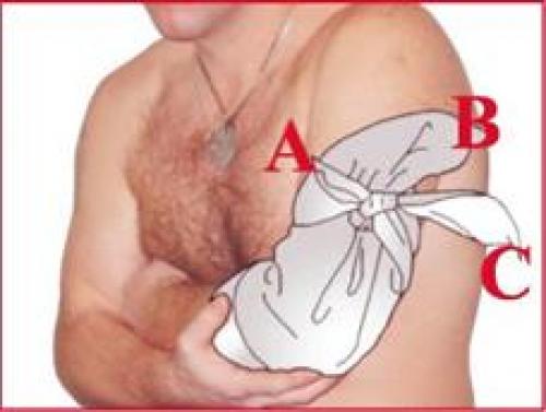 Повязка косыночная. Техника наложения повязок Косыночные повязки