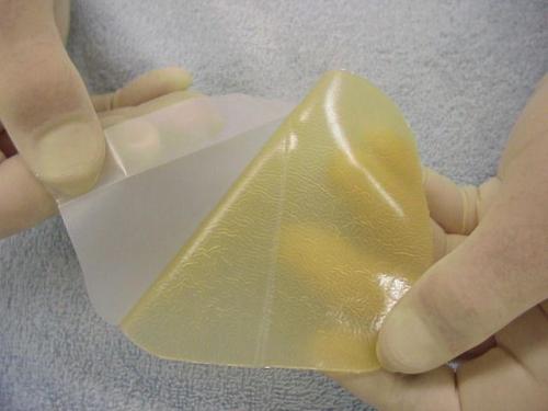 Повязка черепашья сходящаяся на коленный сустав. Техника наложения 09 Повязка черепашья сходящаяся на коленный сустав. Техника наложения 09