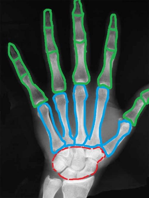 Строение кисти правой руки. Анатомия кисти. Строение костей кисти.