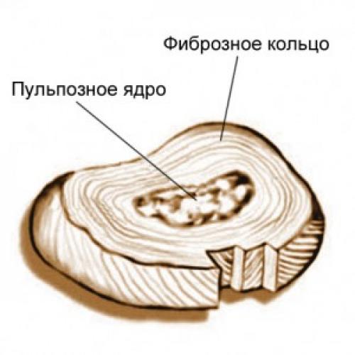 С помощью сустава соединяются крестцовые позвонки. Виды соединений позвоночного столба