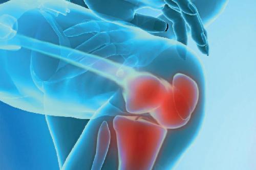 Колено теплое и болит. Колено горячее и болит. В чем причина и что делать 12 Колено теплое и болит. Колено горячее и болит. В чем причина и что делать 12