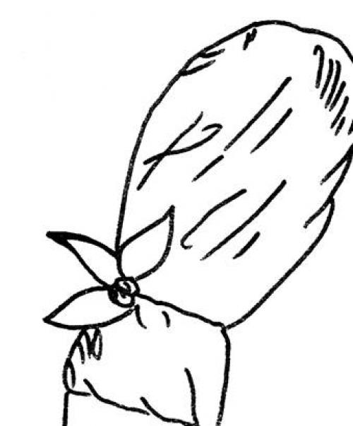 Повязка варежка на кисть. Алгоритм наложения повязки «варежка» на все пальцы кисти.