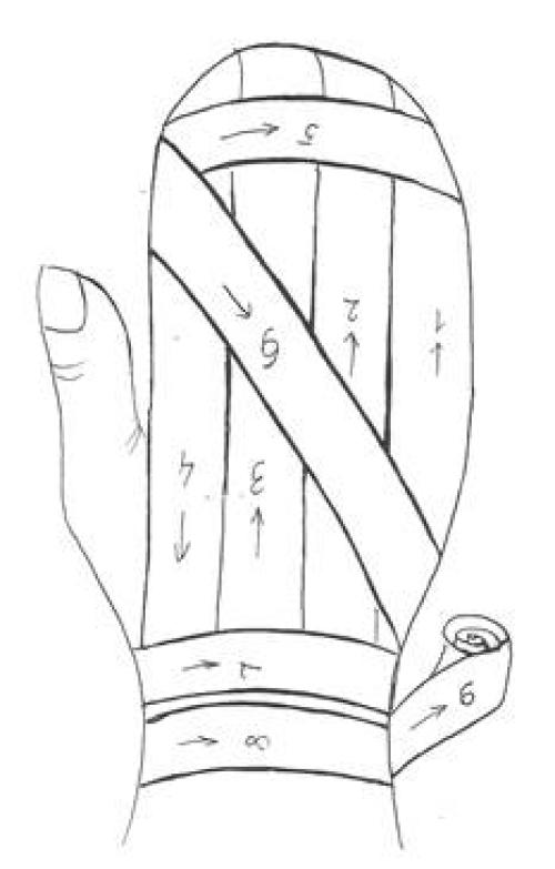 Перевязка пальца на руке бинтом схема