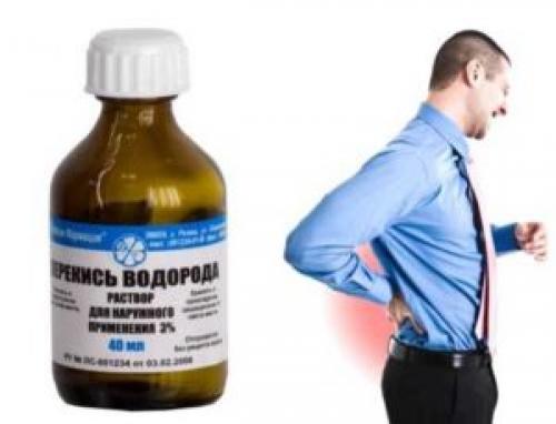 Лечение артроза перекисью водорода по методу Неумывакина. Применение перекиси водорода при артрозе