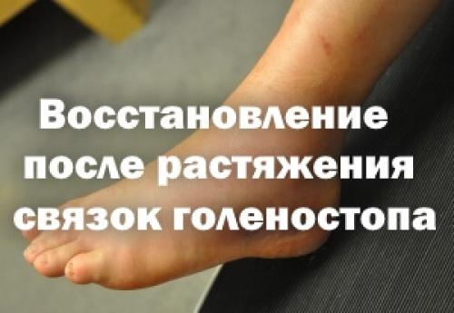Сколько восстанавливаются порванные связки голеностопа. Восстановление после растяжения связок голеностопа