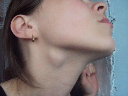 Шишки на пальцах рук чешутся. Основные признаки и различия