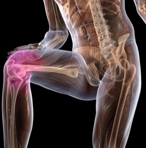 Настойка для суставов с анальгином. Чем полезна «бабушкина растирка» от болей в суставах 07 Настойка для суставов с анальгином. Чем полезна «бабушкина растирка» от болей в суставах 07