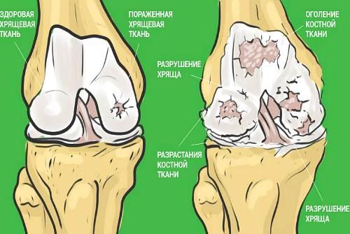 Желатин полезен для суставов. Желатин для суставов: миф или реальная помощь при травмах в спорте?