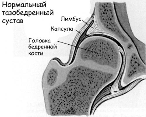 Шишка на суставе пальца руки фото