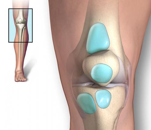 На коленном суставе шишка сбоку, что это может быть. Что это?