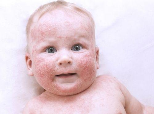 Шишки на пальцах рук чешутся. Основные признаки и различия