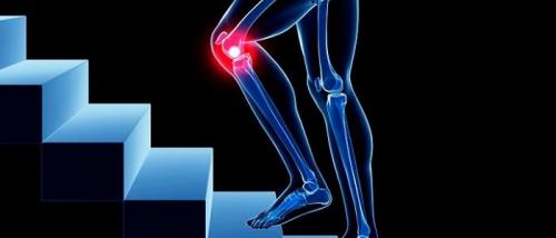 Хрустит коленка и болит. Главные причины боли в колене | Evolutis Clinic | Дзен Светлана Красота | Журнал о здоровье, Лечение ног, Средства для. Хрустит колено при сгибании но не болит: Почему хрустят колени? Советы.