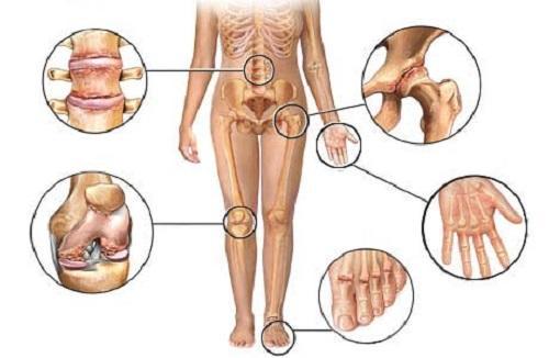 Шишки на суставах пальцев рук чем лечить. Причины нарушения 08 Шишки на суставах пальцев рук чем лечить. Причины нарушения 08