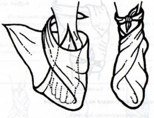 Пращевидная. Косыночные повязки