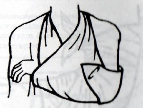 Пращевидная. Косыночные повязки