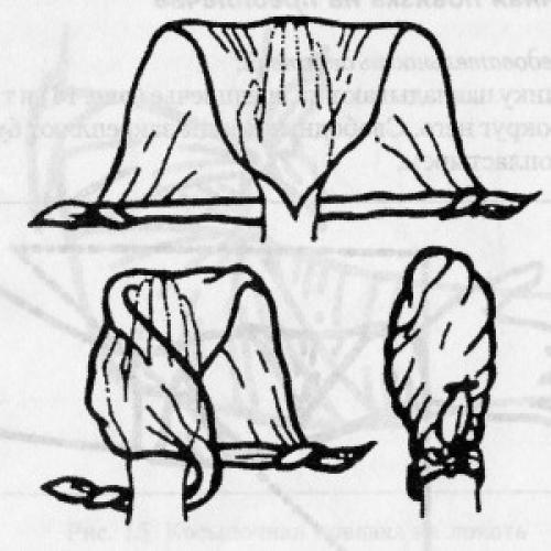 Пращевидная. Косыночные повязки