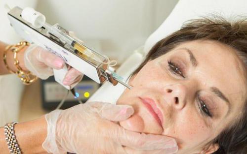 Косметические процедуры для лица после 60 лет. Омоложение лица после 60 лет