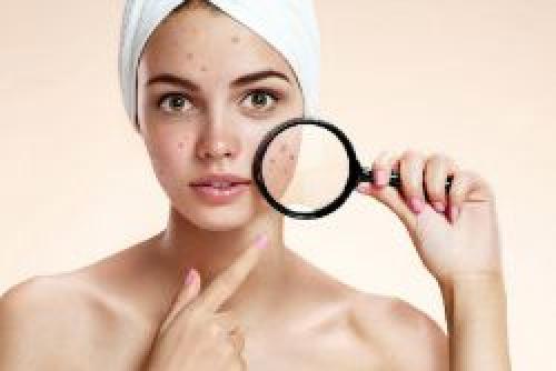 Хлоргексидин от пигментных пятен.