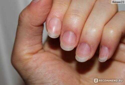 Маникюр с помощью соды. Немного соды только на пользу прекрасному маникюру (фото прилагается)