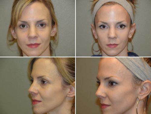 Точки красоты и молодости массаж Шиацу. Схема массажа шиацу для лица