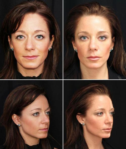 Точки красоты и молодости массаж Шиацу. Схема массажа шиацу для лица