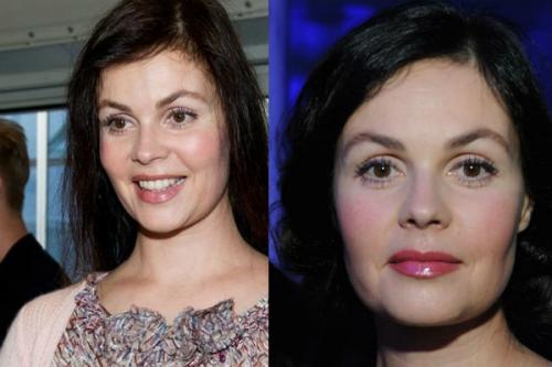 Екатерина Андреева пластика. Екатерина Андреева — делала ли телеведущая пластику?