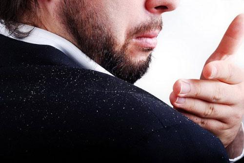 Как мыть голову хозяйственным мылом. Как правильно мыть голову хозяйственным мылом от перхоти?