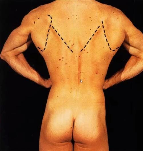 Поверхностные мышцы спины. Анатомия мышц спины. Глубокий слой