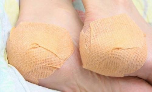 Глицерин с уксусом для рук. Рецепт с уксусом