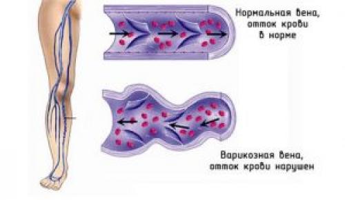 Слабость в коленях причины лечение. Слабость в коленках