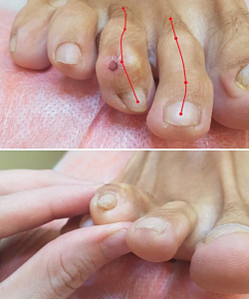 Реабилитация после травмы плеча. Лечебные упражнения 06