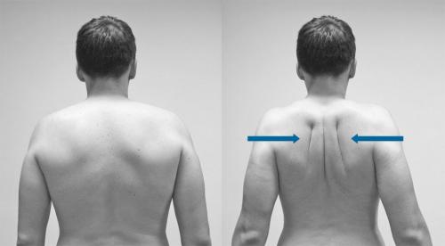Болит и щелкает плечевой сустав. Плечелопаточный периартрит 06 Болит и щелкает плечевой сустав. Плечелопаточный периартрит 06