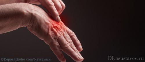 Шишка на суставе пальца руки под кожей твердая. Причины нарушения 01 Шишка на суставе пальца руки под кожей твердая. Причины нарушения 01