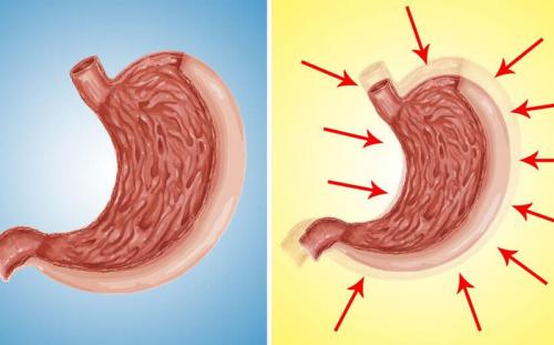 Препараты для уменьшения объема желудка. Как уменьшить желудок естественным путем