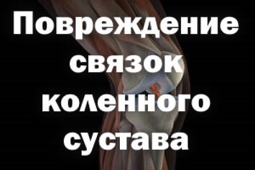 Повреждение связок коленного сустава срок восстановления. Повреждение связок коленного сустава