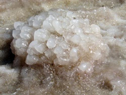 Отложение солей на пальцах рук. Основные причины