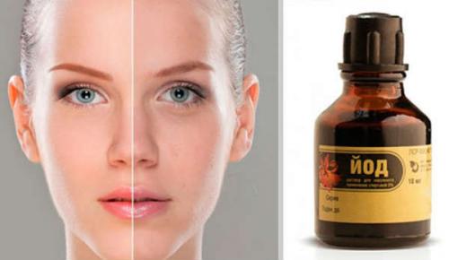 Маска для лица с касторовым маслом йодом медом вазелином. Йод для лица. Рецепты масок для лица с йодом. Отзывы