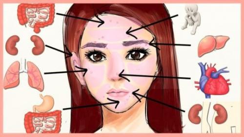 Прыщи, как заболевание внутренних органов. Зоны на лице — проекции внутренних органов