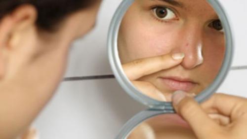 Прыщи по овалу лица. Ищем проекции по «карте прыщей»