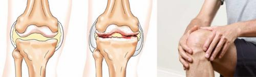 Тибетская медицина лечение суставов. Тибетский метод лечения артроза