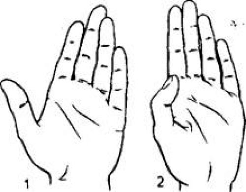 Большой палец руки толстый и короткий (расплющенный). Характер человека по большому пальцу