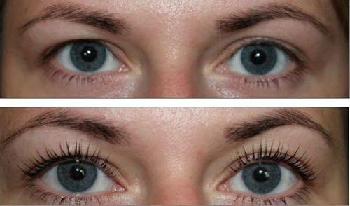 Противопоказания к процедуре Вельвет. Особенности процедуры Вельвет