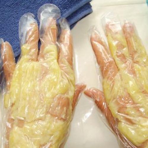 Мазь от зуда и шелушения на руках. Лечение