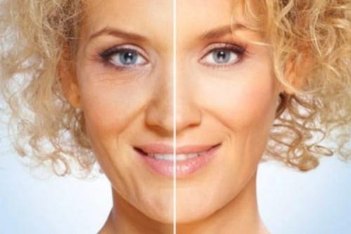 Маски для лица от морщин вокруг глаз. Морщины вокруг глаз: как убрать в домашних условиях