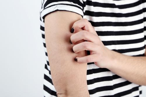 Крем от зуда ног для диабетиков. Профилактика