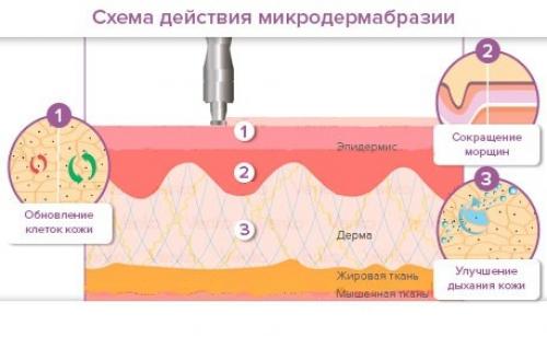 Крем для отбеливания кожи в зоне бикини. Как отбелить кожу в салоне в зоне бикини от загара