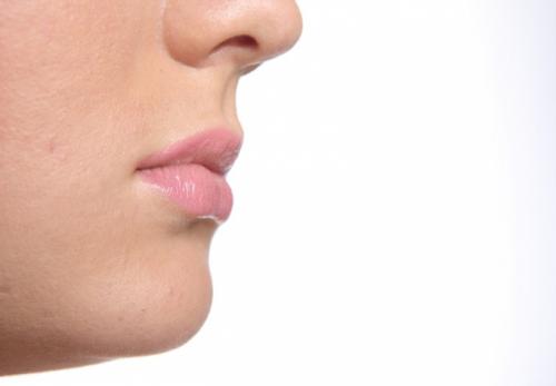 Пористая кожа, как избавиться. Совет 1: Как избавиться от пористой кожи