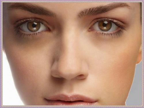 Желтизна под глазами у женщин. Как убрать желтые пятна под глазами?