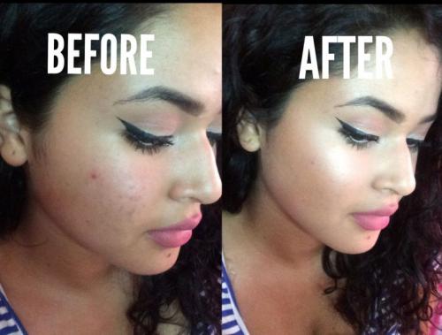 Макияж для пигментированной кожи. Невидимый секрет: лучшие способы замаскировать пигментные пятна на лице